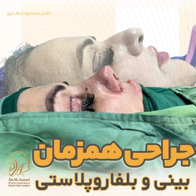 نمونه جراحی همزمان بینی و پلک دکتر انظاری