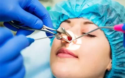 جراحی اندوسکوپی بینی در اردبیل