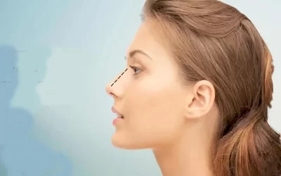 تفاوت جراحی بینی فانتزی و نیمه فانتزی