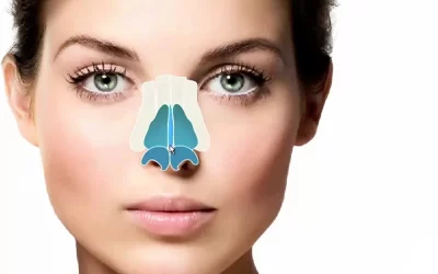 پیوند غضروف در جراحی بینی