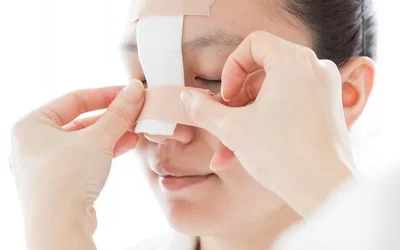 جراحی بینی شکسته