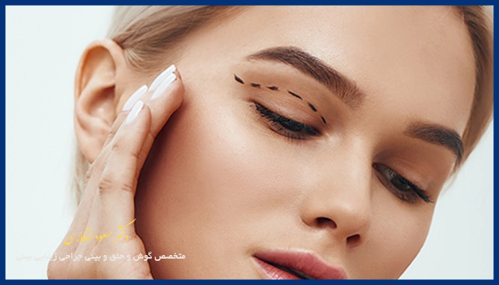 مزایای جراحی بلفاروپلاستی