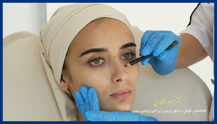 مزایای تیپ پلاستی