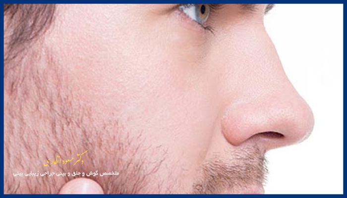 جراحی بینی مردانه 