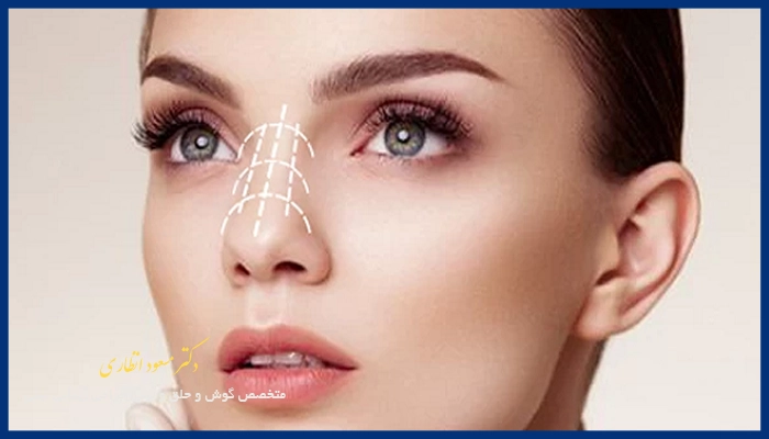 چه عواملی باعث کجی بینی میشود؟