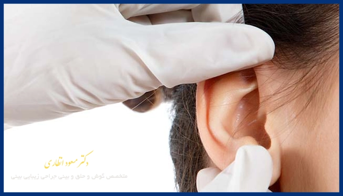 مهمترین نکاتی که بعد از جراحی گوش باید رعایت کرد؟