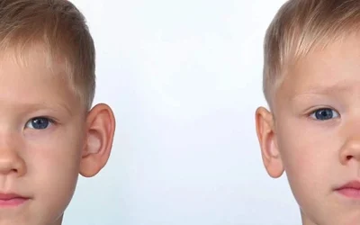 بهترین سن برای جراحی زیبایی گوش یا اتوپلاستی