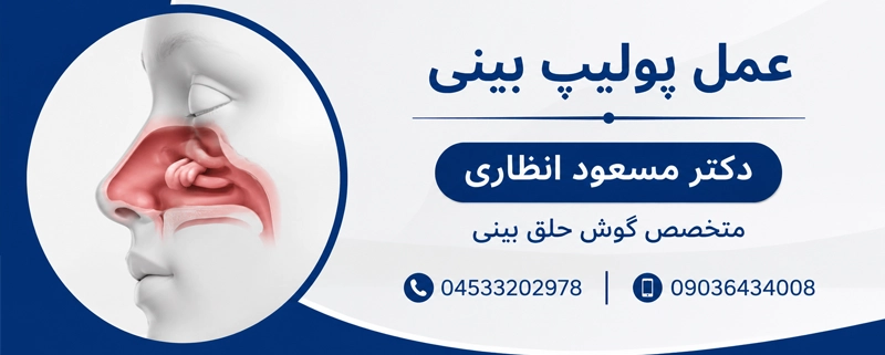 عمل پولیپ بینی